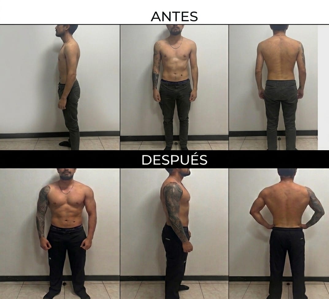 Caso 3 – Hipertrofia muscular, 26 años