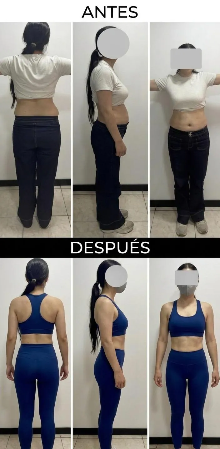 Caso clínico 1: recomposición corporal en paciente de 30 años con dieta hiperproteica, entrenamiento de fuerza y tirzepatida
