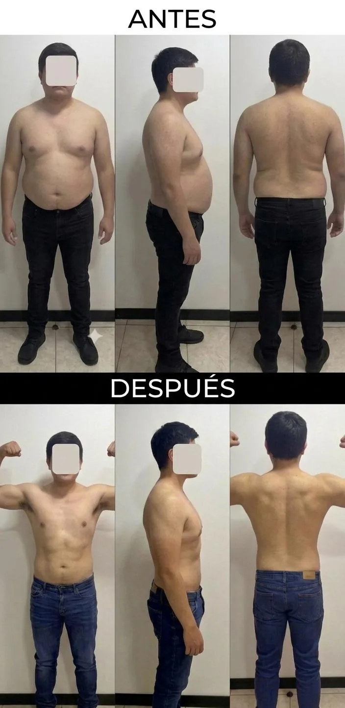 Caso clínico 2: control glucémico en paciente de 28 años con prediabetes tratada con semaglutida, dieta hiperproteica y fuerza