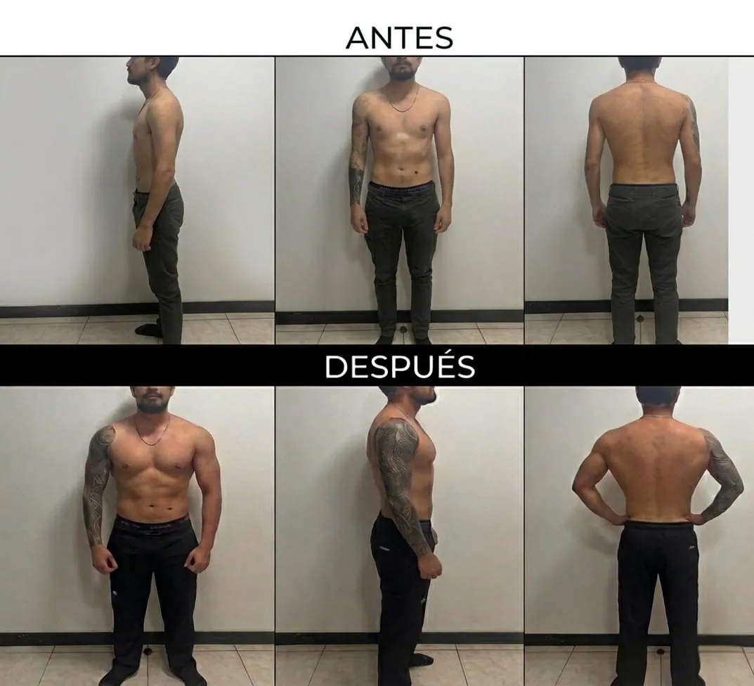 Caso clínico 3: aumento de masa muscular en paciente de 26 años con plan nutricional y entrenamiento de fuerza